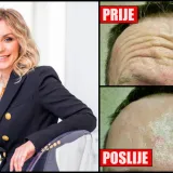 Dr. Ana Maletić, specijalist plastične, rekonstrukcijske i estetske kirurgije/Foto: Poliklinika Maletić