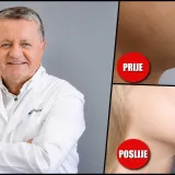 Dr. Du&scaron;ko Maletić svojom "formulom" za podbradak postiže sjajne rezultate/ Foto: Poliklinika Maletić