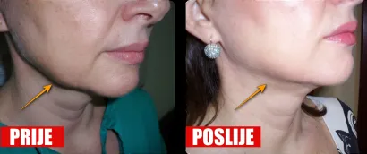 Foto: Poliklinika Maletić