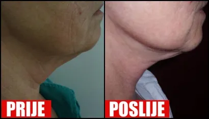 Foto: Poliklinika Maletić