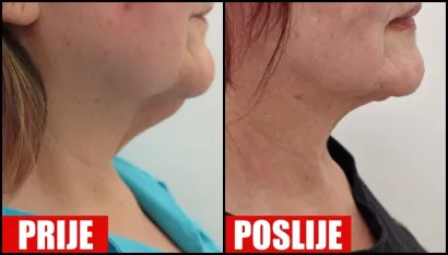Foto: Poliklinika Maletić