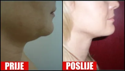 Foto: Poliklinika Maletić